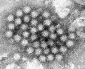 Norovirus is surging in the U.S. this winter compared to past years: CDC