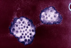 Norovirus cases spike above 5-year average, PHAC says